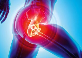 hip replacement cost in india