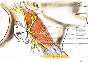 Carotid Endarterectomy Surgery Cost in India